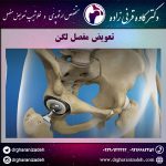 تعویض مفصل لگن