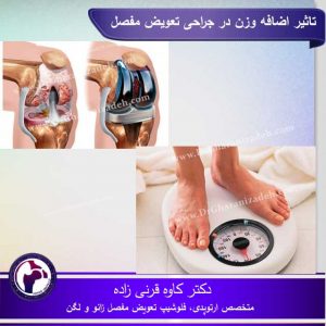 تاثیر-اضافه-وزن-در-جراحی-تعویض-مفصل