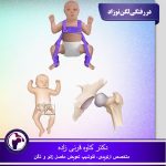 عکس-دررفتگی-لگن-نوزاد