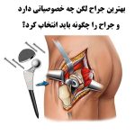 جراح لگن