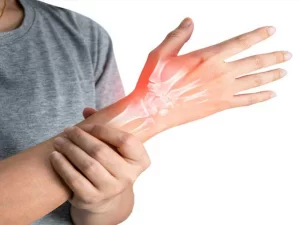 درمان شکستگی استخوان - دکتر کاوه قرنی زاده