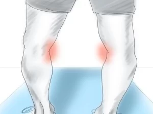 جراحی پای پرانتزی یا استئوتومی - دکتر کاوه قرنی زاده