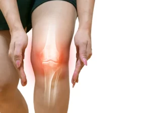 سیاه شدن استخوان زانو - دکتر کاوه قرنی زاده