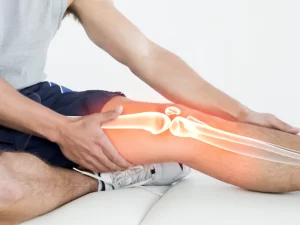 درمان دررفتگی کشکک زانو - دکتر کاوه قرنی زاده