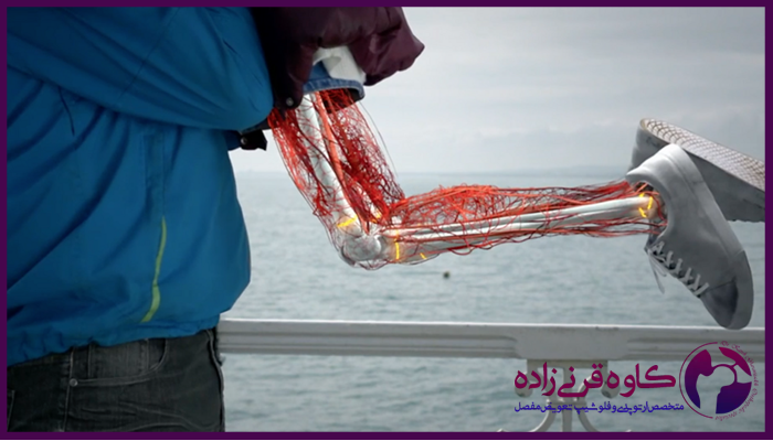 علت استخوان سازی اضافه در بدن