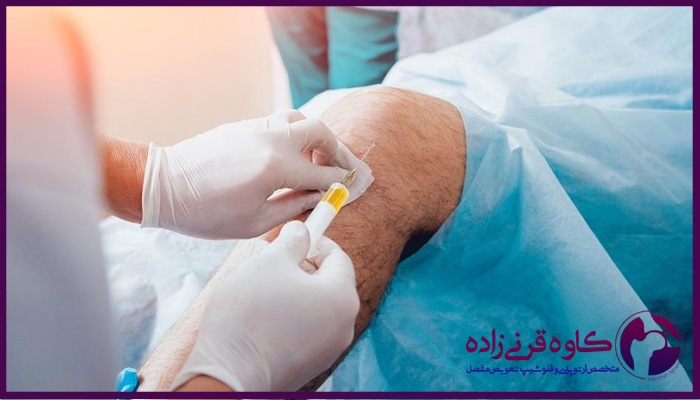 مراقبت حیاتی بعد از تزریق ژل زانو