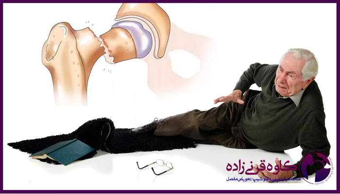 توانبخشی و کنترل پوکی استخوان در سالمندان