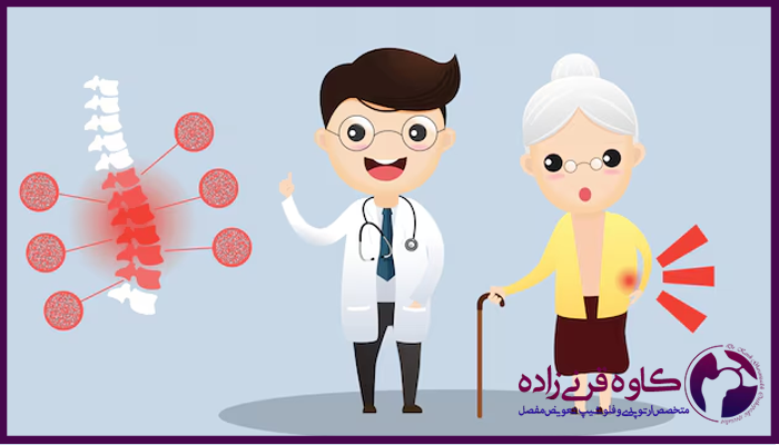 چند درصد پوکی استخوان خطرناک است؟