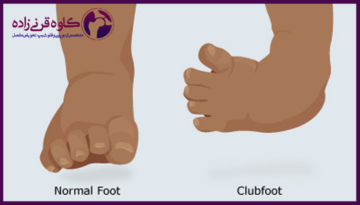 علت و علائم کلاب فوت و پاچنبری